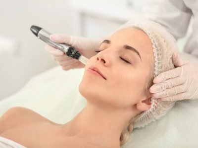 Microneedling With Serum Induction