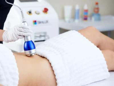 Ultrasound Fat Cavitation with RF Skin Tightening1